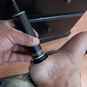 electric foot file callus remover