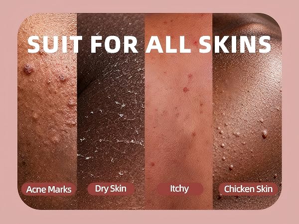 Suit for All Skins