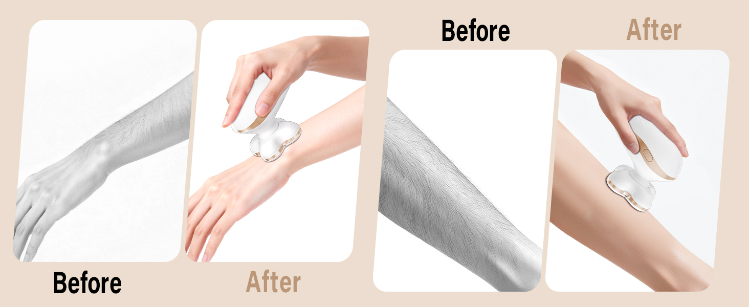 womens electric shaver