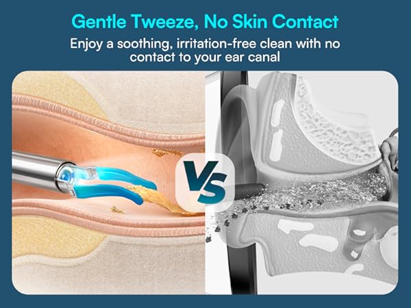 GentleTweeze,more safe