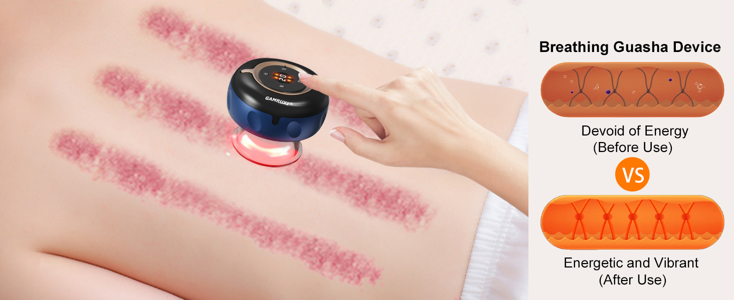 cupping set