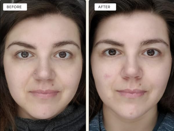 Get Transformative Results