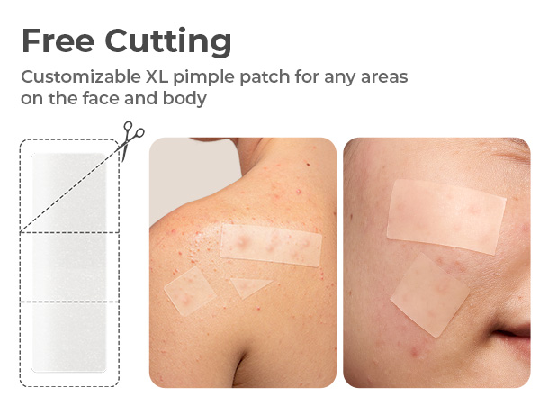 TKTK acne patches