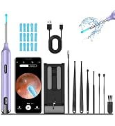 Ear Wax Removal Tool Camera, Ear Wax Camera, 1200P HD Ear Camera with 6 LED Light, Ear Cleaning K...