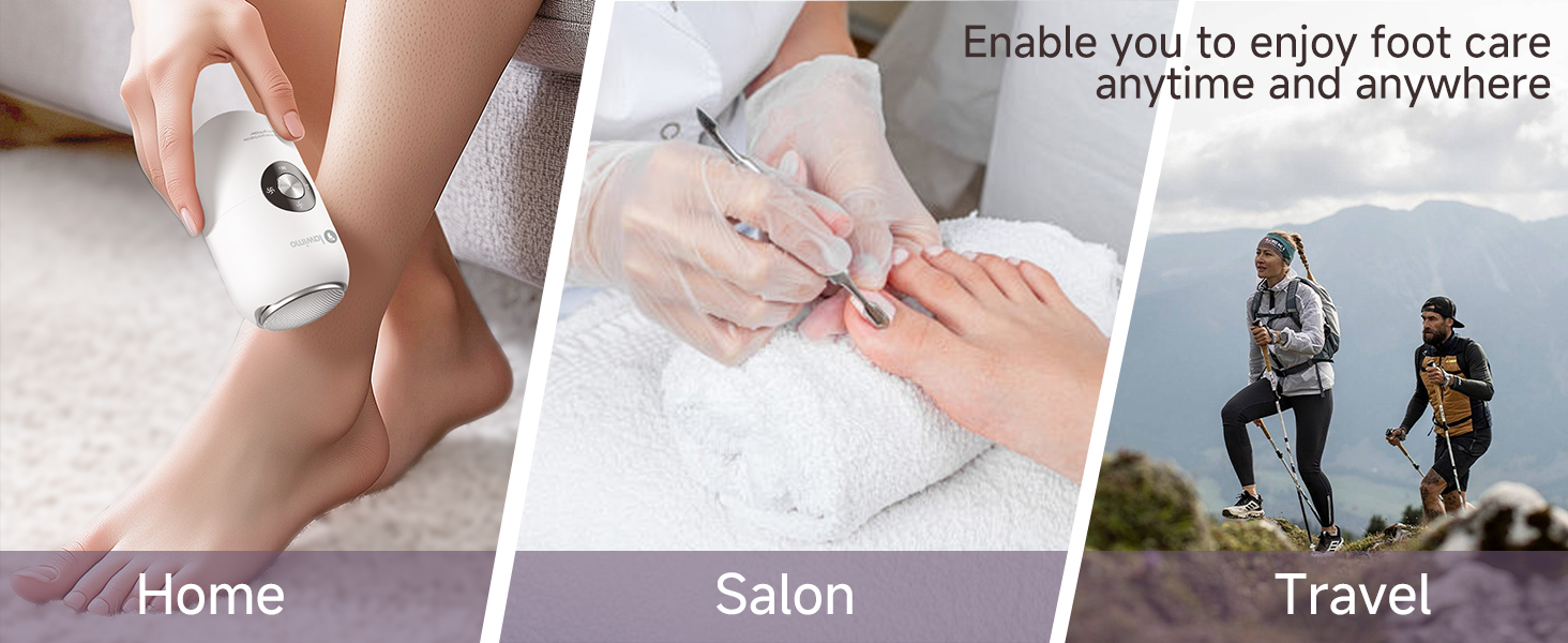 Electric Foot Callus Remover