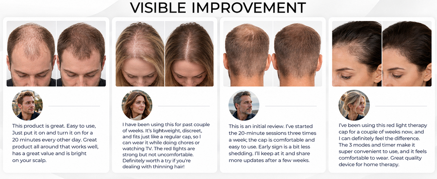 Red Light Therapy for Hair