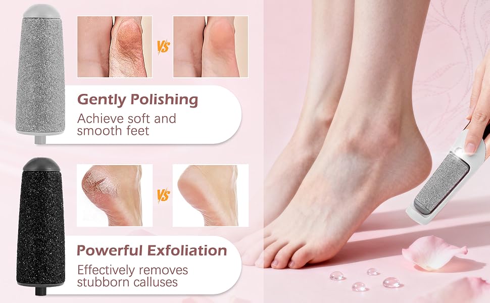 Electric Callus Remover for Feet