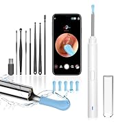 Ear Wax Removal, Ear Cleaner with Camera, Ears Wax Removal Kit with 1296P HD Ear Otoscope with 6 ...
