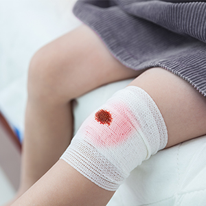 Crawling can cause abrasion on the knees.