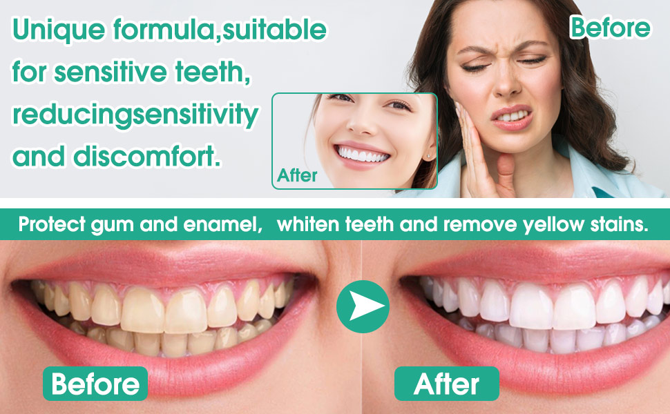 hydroxyapatite gum