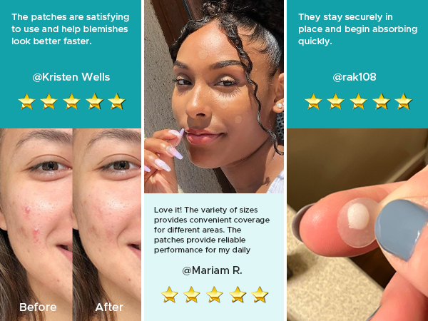 pimple patches