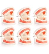 ZENFUN 6 Packs Dental Teeth Model, Dental Demonstration Model for Study, Standard Teeth Models, P...
