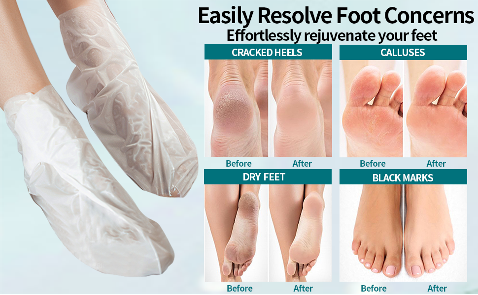 foot masks moisturizing socks