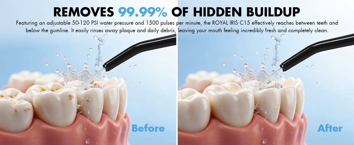 power dental flossers