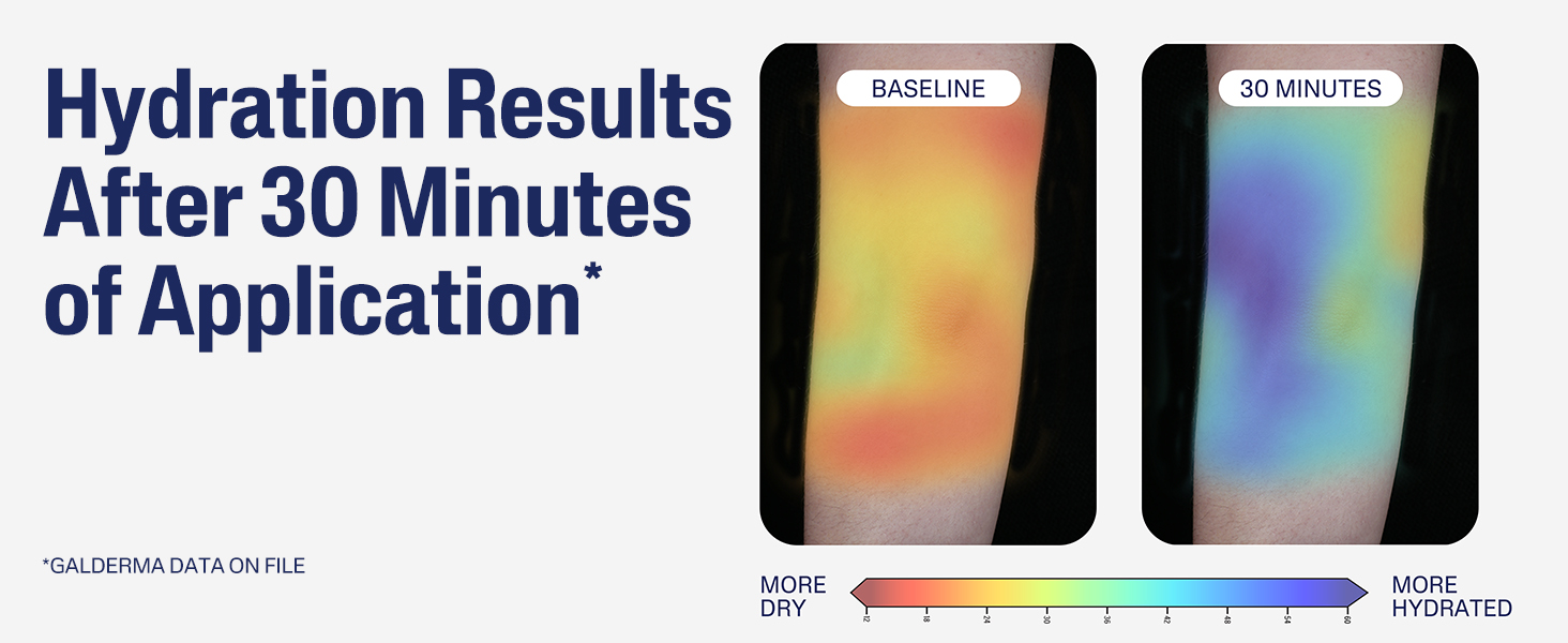 Hydration Results