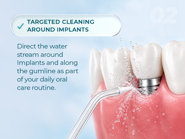 IDEAL FOR IMPLANTS