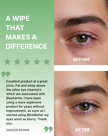 blinkbetter customer review