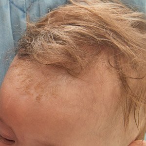 head