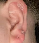 clear ear 625