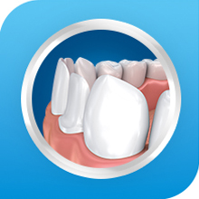 Teeth Whitening