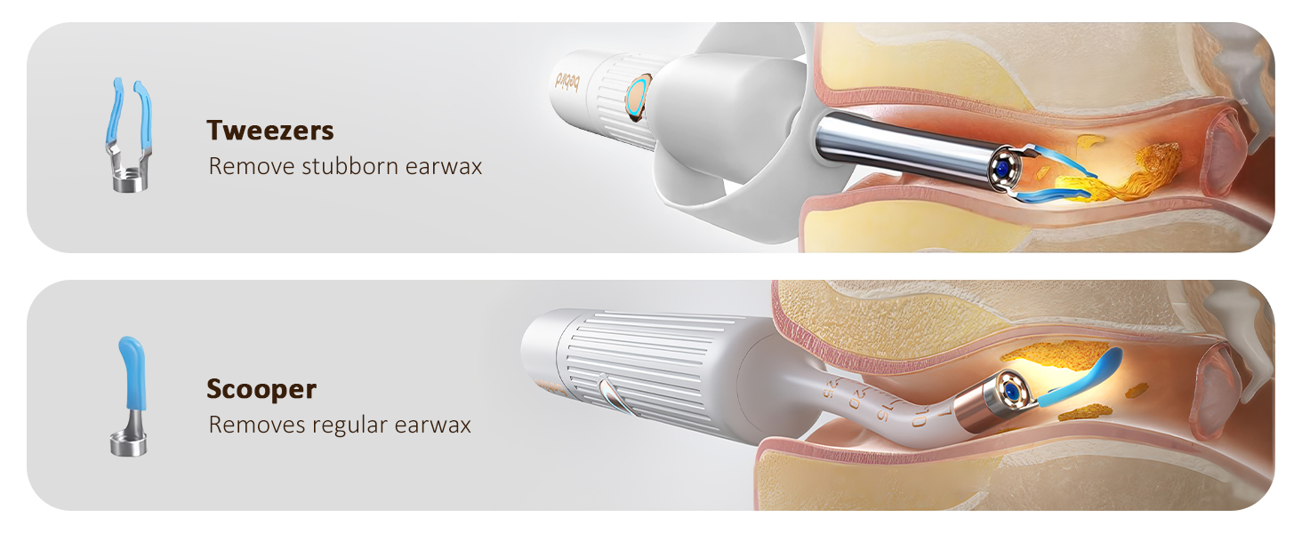 ear camera wax removal