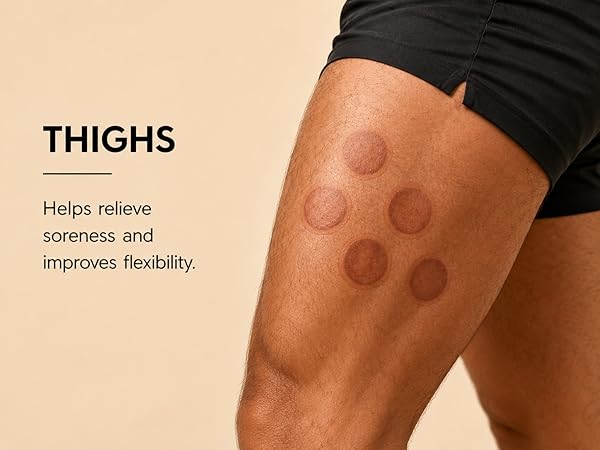 cupping therapy set