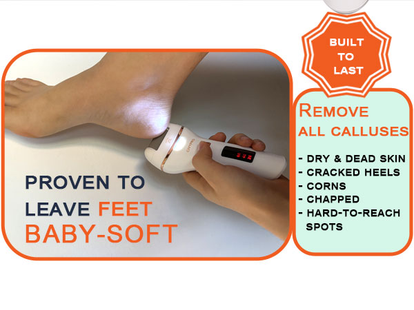 callus remover for feet