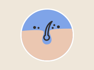Prevent Ingrown Hairs