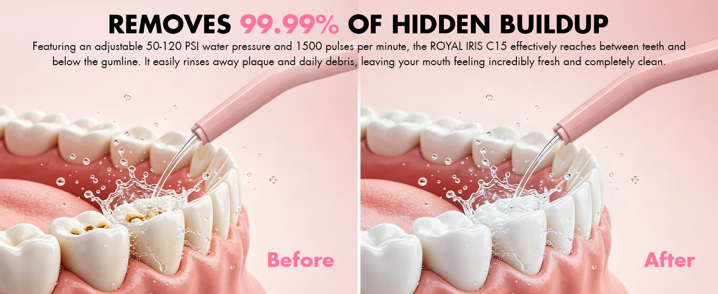 water picks for teeth cleaning and flossing