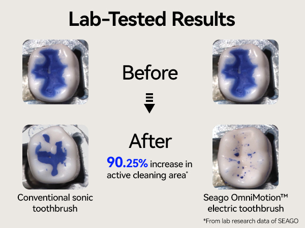 electric toothbrush