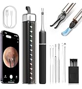 CozyZen Ear Wax Removal Tool S5 with 10 MP Camera Otoscope, Omnidirectional Tweezer, Crodless Ear...