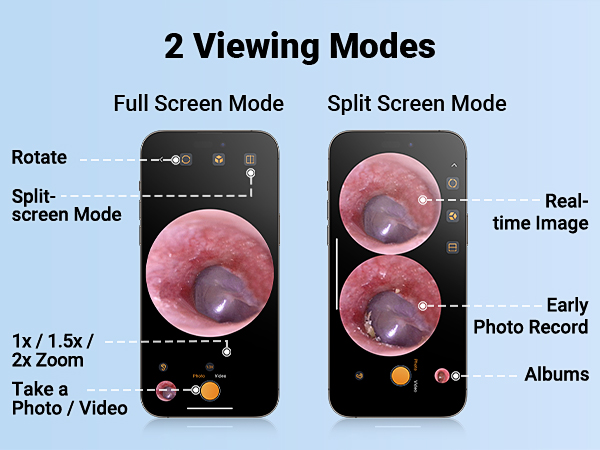 otoscope with light ear scope digital otoscope for kids smart otoscope for iphone