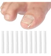 10Pcs Ingrown Toenail Correction Strips Brace Kit,Ingrown Toenail Corrector Straightener Strips R...