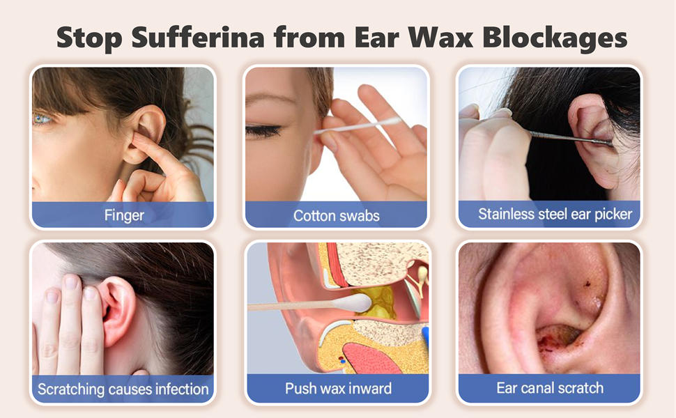Ear Wax Remover