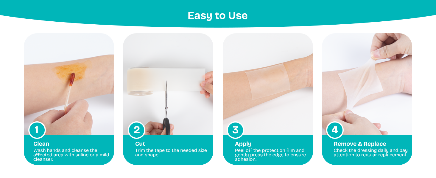 pimple patch roll-Easy to Use