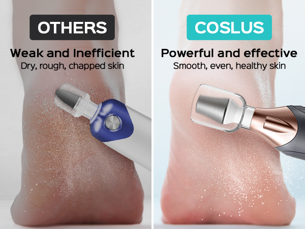 electric toenail clippers for seniors