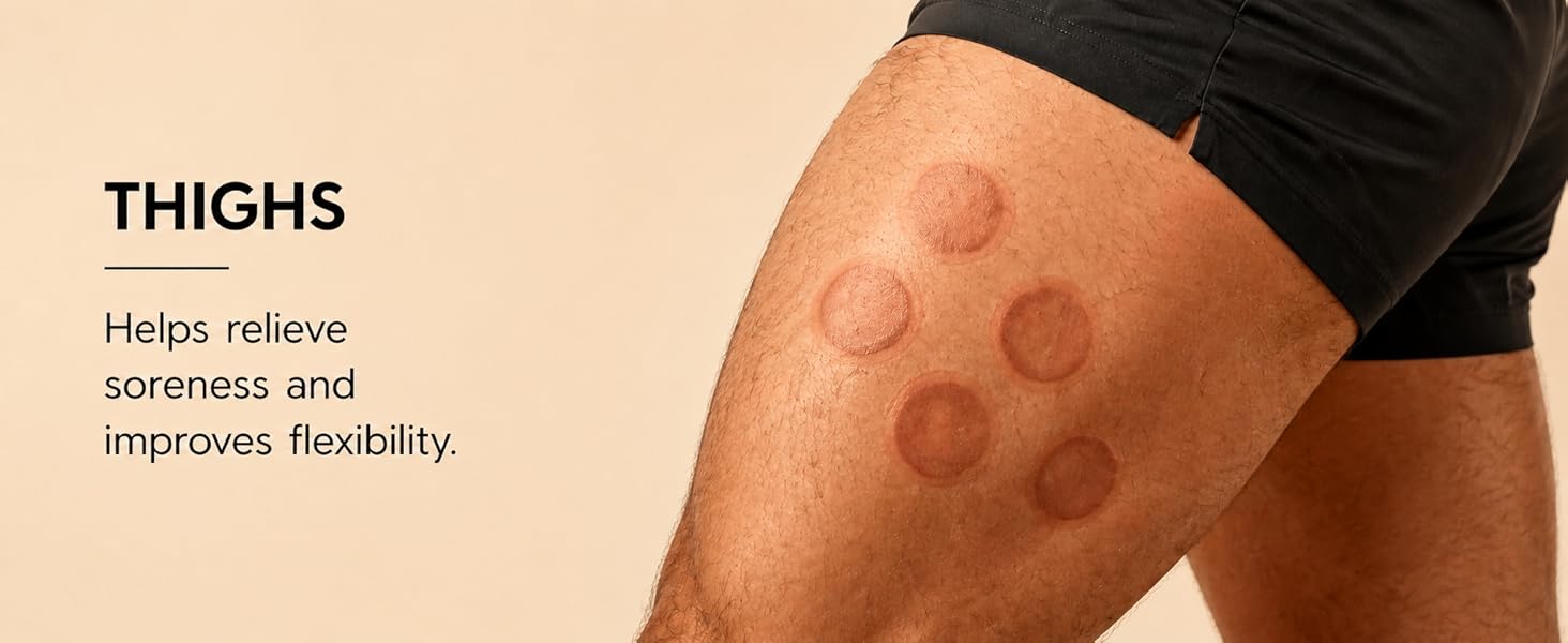 cupping therapy set