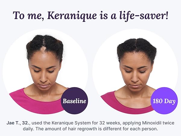 Keranique Scalp Massager Silicone Head Scrubber Hair Growth Stimulator Shower Massage Stress Relax.