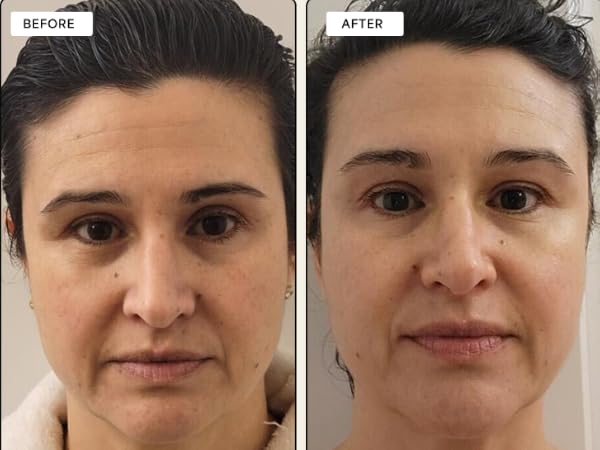 Plump & Detoxify