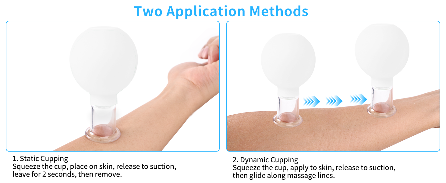 Meifuly Facial Cupping Set
