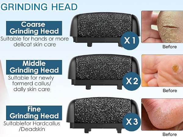 Foot File