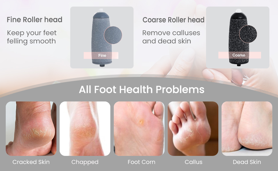 coarse skin remover