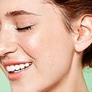 pimple patches for face