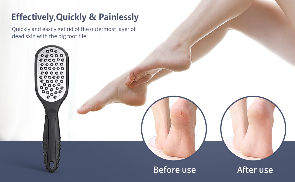 foot scrubber callus remover for feet pumice stone for feet pedicure tools foot file foot care callu