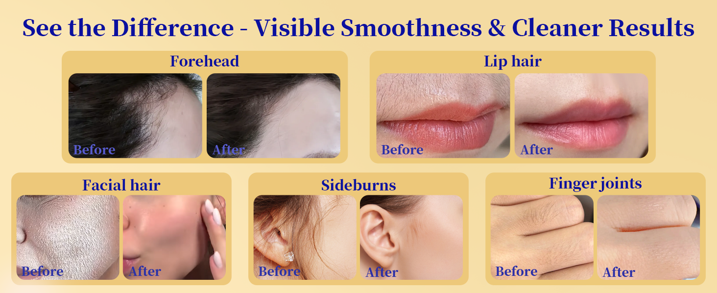 facial hair removal for women