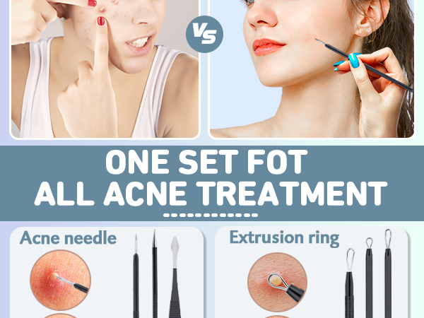 Acne Tools, Acne Kit for Blackhead,Blemish