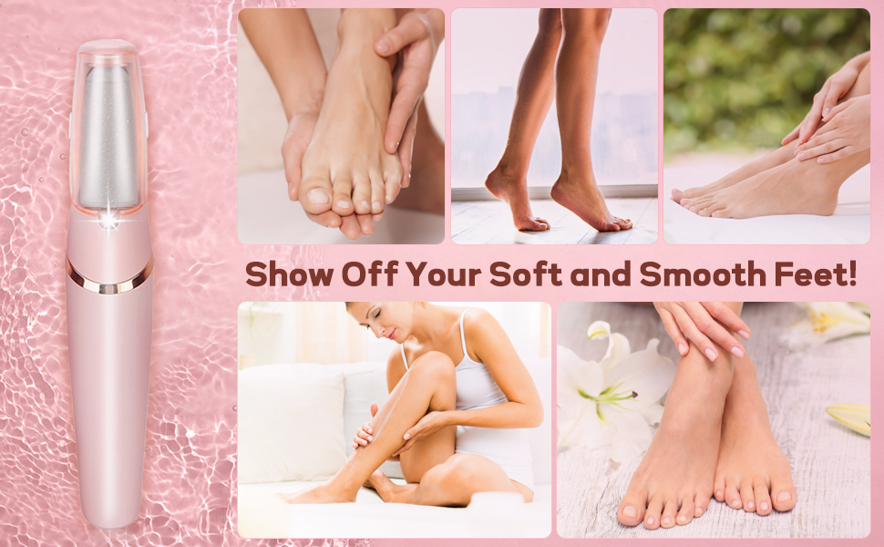 Callus Remover for Feet