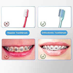 toothbrushes for braces