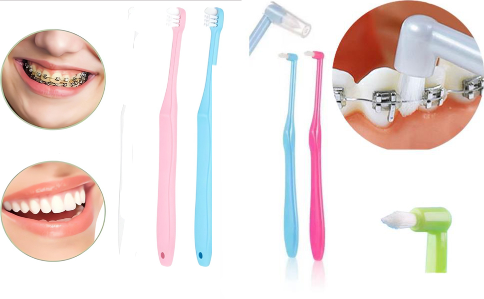 Tooth Stain Remover,