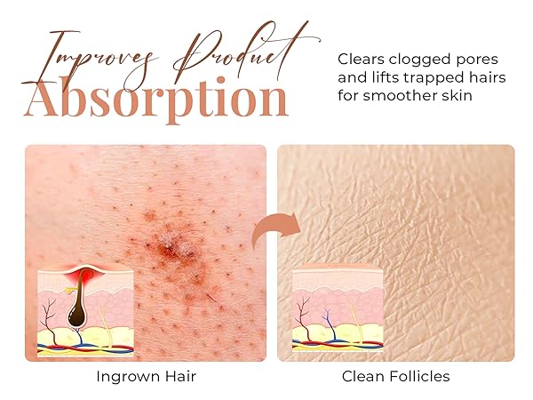 exfoliating body scrubber